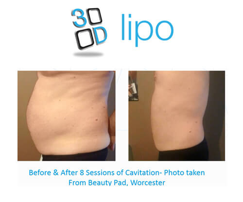 beforeafter2
